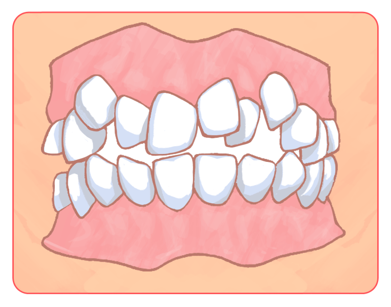 歯並びにコンプレックスがあるあなたに知っていて欲しいこと