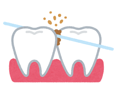 デンタルフロスを積極的に使おう！