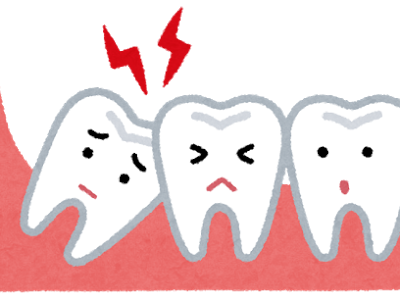 親知らずはなぜ生えてくる？