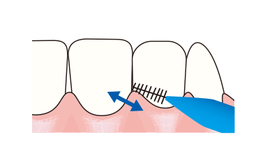 歯間ブラシ使ってますか？