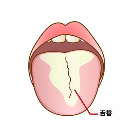 舌はキレイですか？