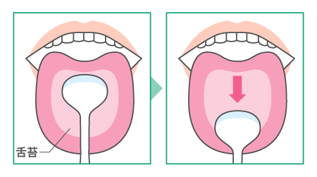 舌はキレイですか？