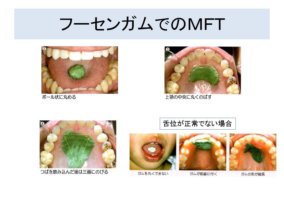 院内セミナー＆勉強会を開催いたしました