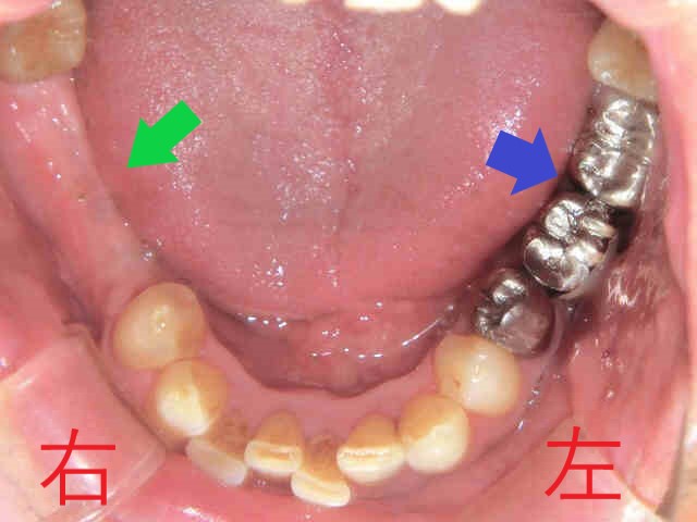 術前レントゲン