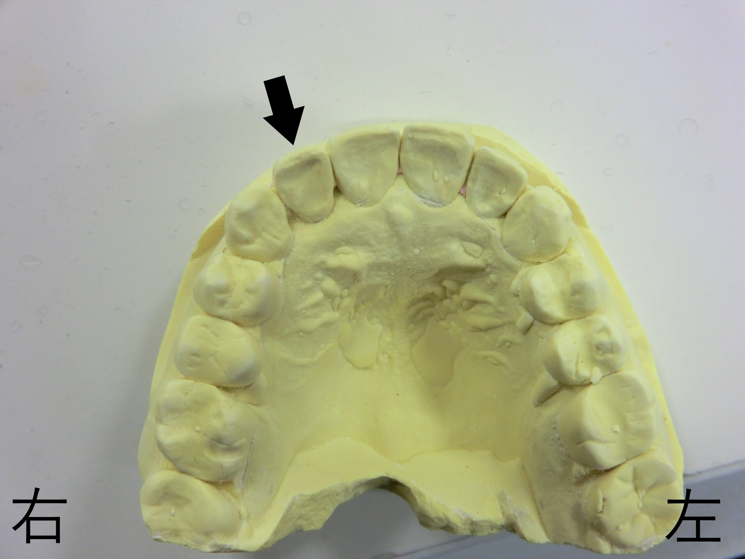 術後レントゲン