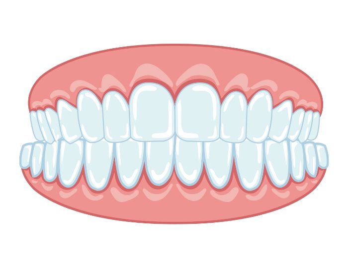 安心パッケージ