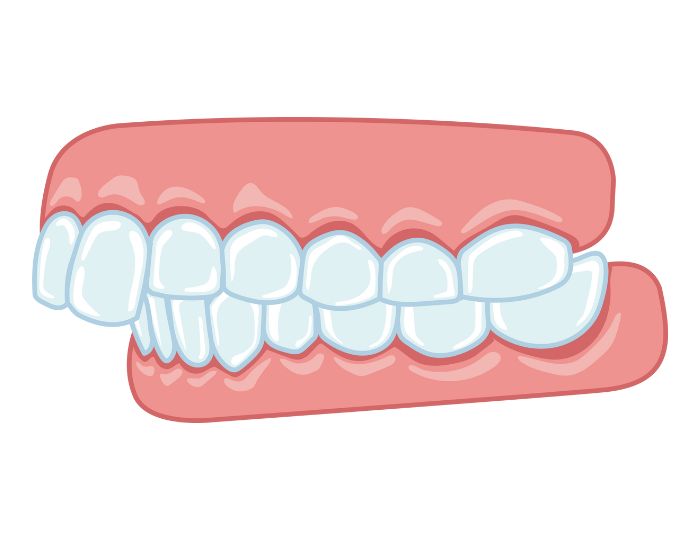 鼻呼吸の習慣化