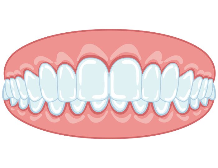 安心パッケージ