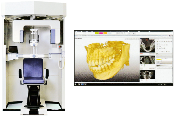 歯科用CT