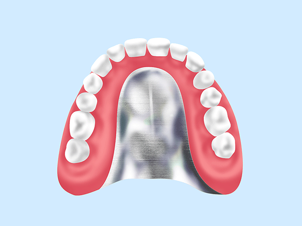 自費診療の入れ歯